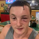 Dude injured his head when he dived into rock