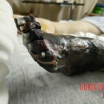 Elderly woman was fused to wheelchair for 8 days