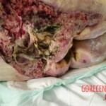 Elderly woman was fused to wheelchair for 8 days