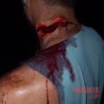 Five people injured during bloody fight in Ecuador