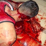 Five people injured during bloody fight in Ecuador