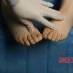 Feet of a woman's corpse inspection Forensic autopsy with educational annotations