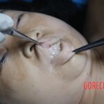 Examination of the teeth and lips Forensic autopsy with educational annotations