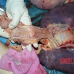 Tracheas, lungs Forensic autopsy with educational annotations