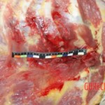 Hemorrhage in the chest area Forensic autopsy with educational annotations