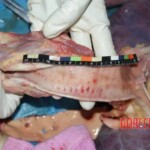 Larynx, measurements 1 Forensic autopsy with educational annotations
