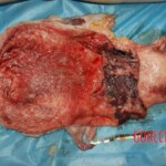 Epiglottis Forensic autopsy with educational annotations