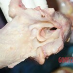 Larynx Forensic autopsy with educational annotations