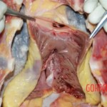 Lower esophagus, hemorrhage 2 Forensic autopsy with educational annotations