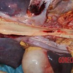 Lungs, kidney, esophagus Forensic autopsy with educational annotations