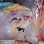 Pulmonary hemorrhage. Measurements Forensic autopsy with educational annotations