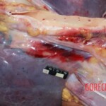 Pulmonary hemorrhage Forensic autopsy with educational annotations