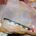 The inner part of the peritoneum Forensic autopsy with educational annotations