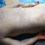 Cadaveric spots Forensic autopsy with educational annotations