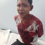 Guy defended himself from robber and painfully detained him