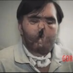 Guy survived suicide attempt with shotgun