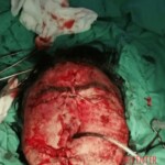 Guy survived suicide attempt with shotgun