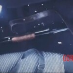 Guy survived suicide attempt with shotgun