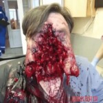 Guy survived suicide attempt with shotgun