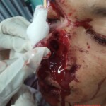 Headless male corpse discovered in Indonesian jungle