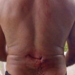 Man sought medical treatment after alligator attack