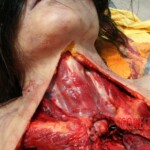 Outdoor examination and autopsy of young Chinese woman