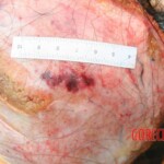 Outdoor examination and autopsy of young Chinese woman