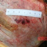 Outdoor examination and autopsy of young Chinese woman