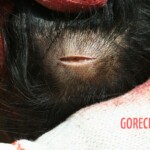 Outdoor examination and autopsy of young Chinese woman