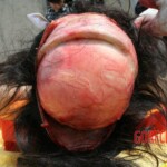 Outdoor examination and autopsy of young Chinese woman