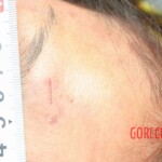 Outdoor examination and autopsy of young Chinese woman