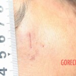 Outdoor examination and autopsy of young Chinese woman