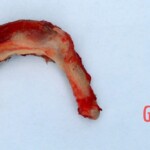 Outdoor examination and autopsy of young Chinese woman