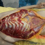 Outdoor examination and autopsy of young Chinese woman