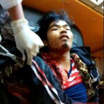 Purse thief died after collision with truck