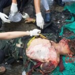 Thai man crushed by truck