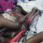 Two Somalis suffered serious injuries in traffic accident