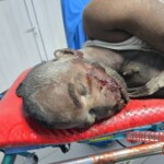 Two Somalis suffered serious injuries in traffic accident