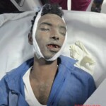 Two Somalis suffered serious injuries in traffic accident