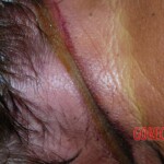 68-year-old woman strangled by almond peeling machine