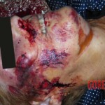 68-year-old woman strangled by almond peeling machine