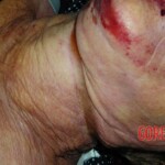 68-year-old woman strangled by almond peeling machine