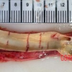 68-year-old woman strangled by almond peeling machine