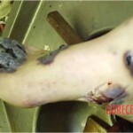 Autopsy of HIV-positive and drug-addicted man