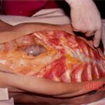 Autopsy of young Thai man