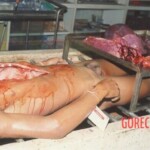 Autopsy of young Thai man