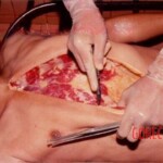 Autopsy of young Thai man