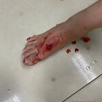 Boy attacked and bitten by stray dog