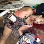 Brazilian woman shot in face