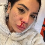 Curvy influencer Soraya Riffy mutilated after rape